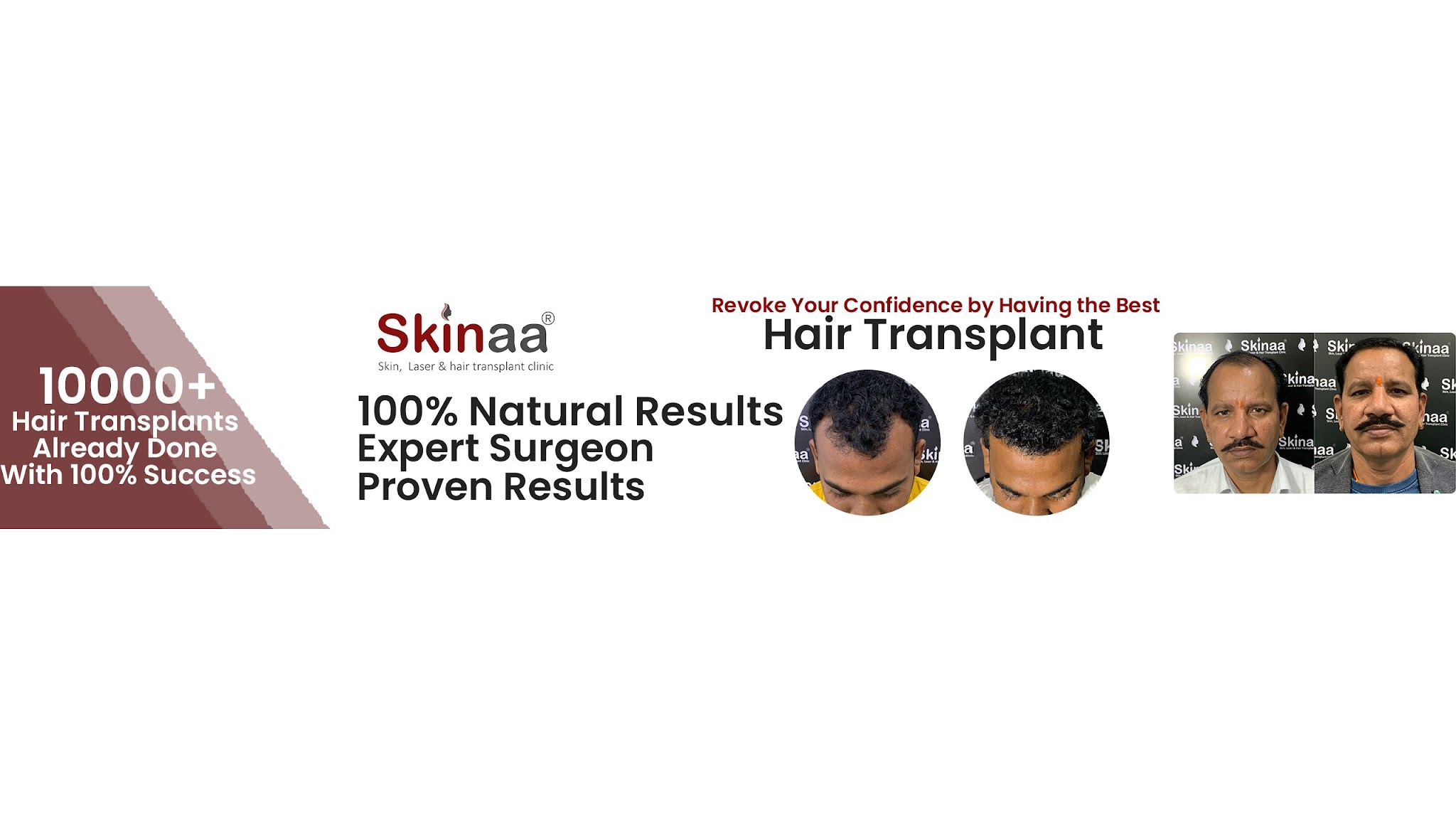 Skinaa Clinic YouTube banner