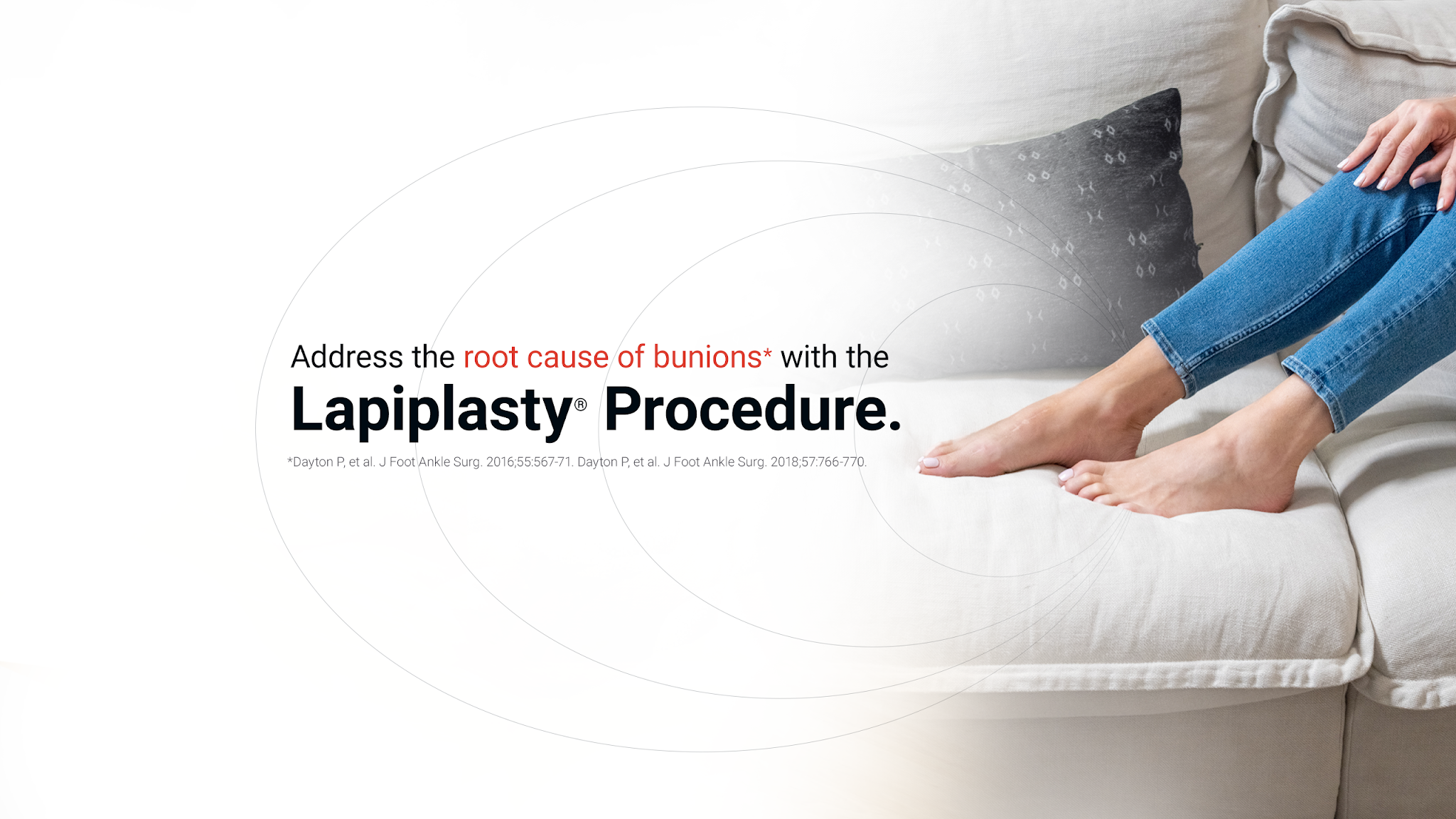 Lapiplasty 3D Bunion Correction YouTube banner