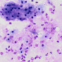 British Association for Cytopathology YouTube thumbnail